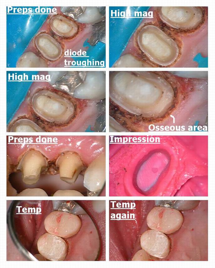 Resize of Premolar pg 4.jpg